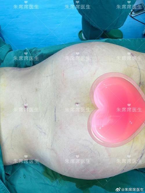 汕头陈静医学整形美容外科诊所地址电话营业时间