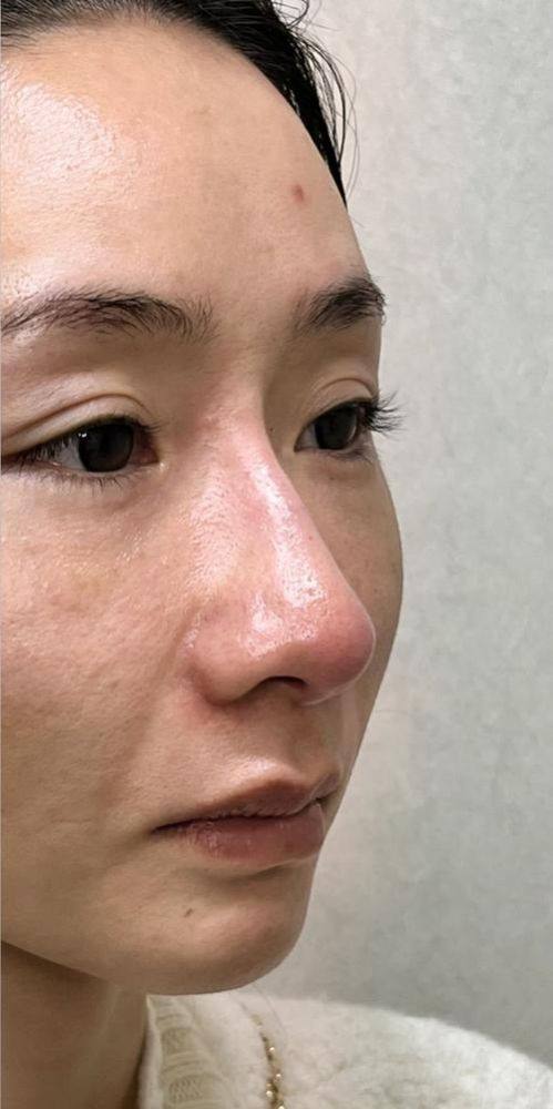 普宁伊丽莎白医疗美容诊所收费价格表/收费标准