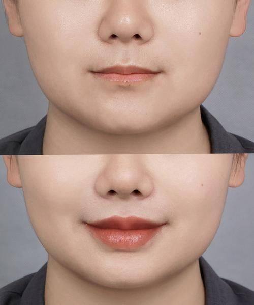 兰州兰熙医疗美容诊所是正规医院吗？