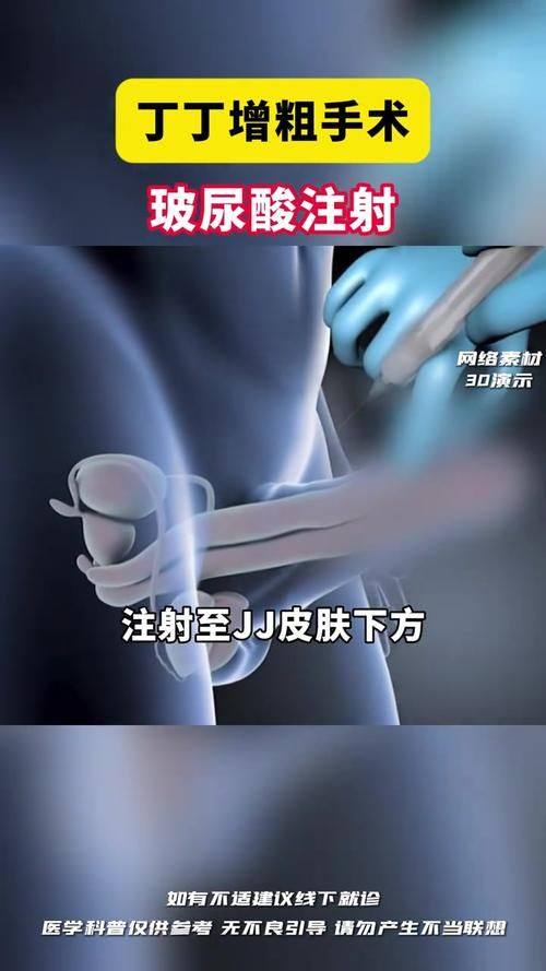 覃寿安医生口碑评价及真人实例