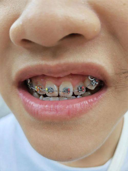 广州优齿社口腔医生团队实力强大及骨干医生简介