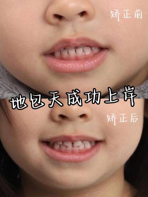 广州优齿社口腔地址电话营业时间