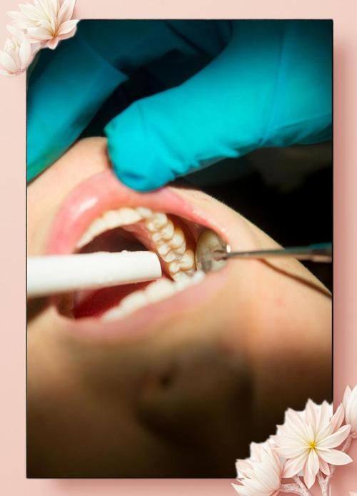 青岛爱齿乐口腔门诊特色项目及技术优势