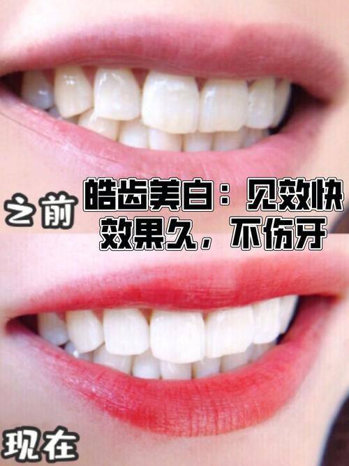 欧忠辉医生擅长项目