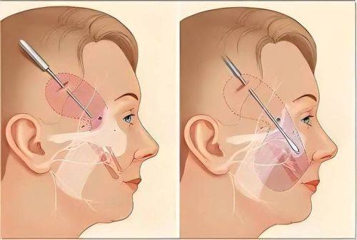 陈静医生预约挂号