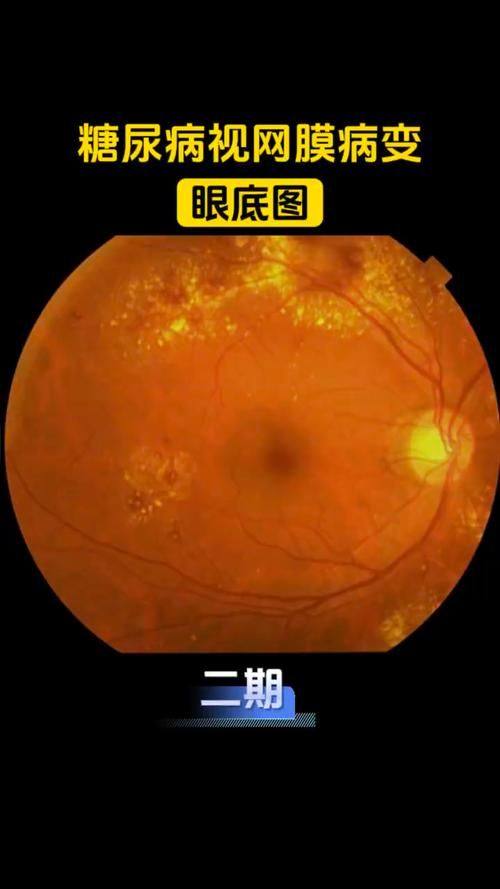 河南大学淮河医院眼科详细的预约挂号方式及流程