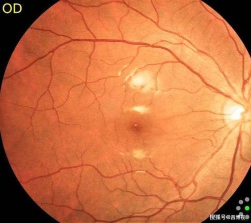 上海爱尔清亮眼科医院（青浦分院）详细的预约挂号方式及流程