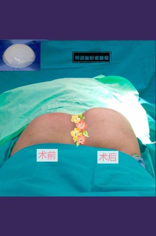 长沙卓而美整形医院特色项目及技术优势