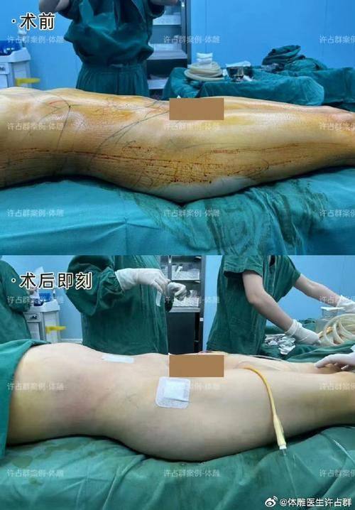 长沙逸韩医学美容医院特色项目及技术优势