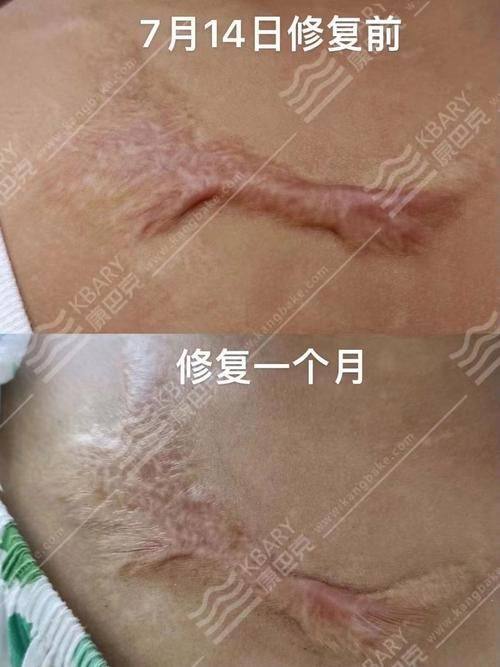 普宁伊丽莎白医疗美容诊所医生团队实力强大及骨干医生简介