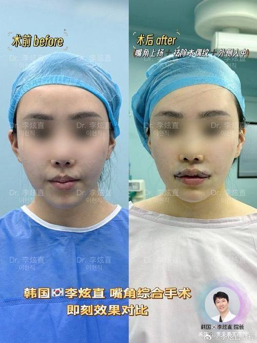 长沙逸韩医学美容医院是正规医院吗？