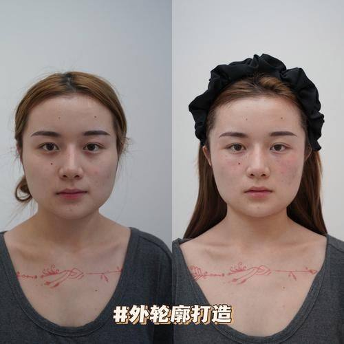 汕头陈静医学整形美容外科诊所是正规医院吗？