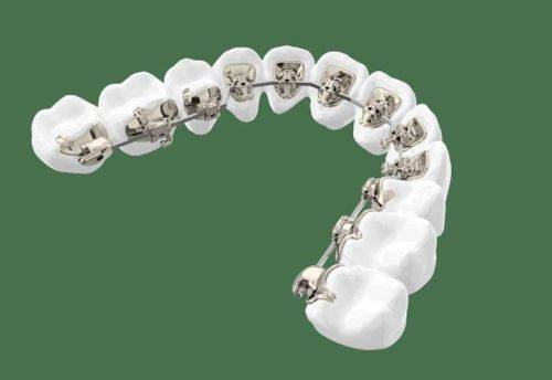 浙江杭州明嘉齿科真人口碑评价怎么样？