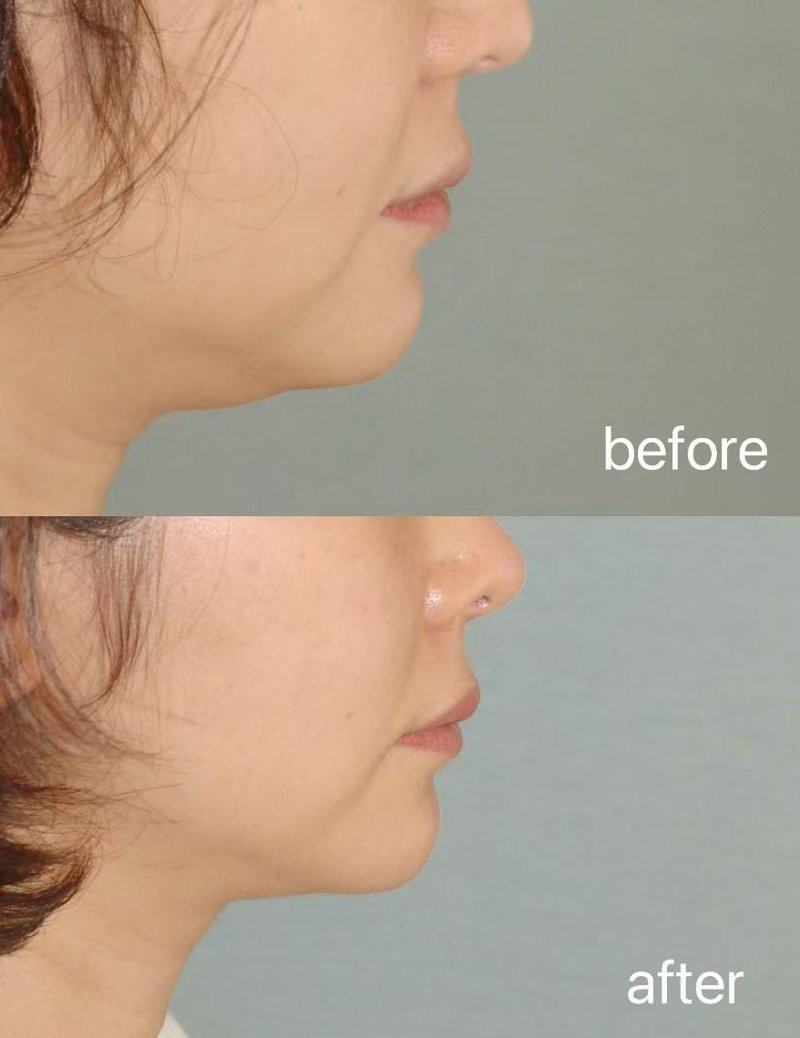 戴浩医生擅长项目