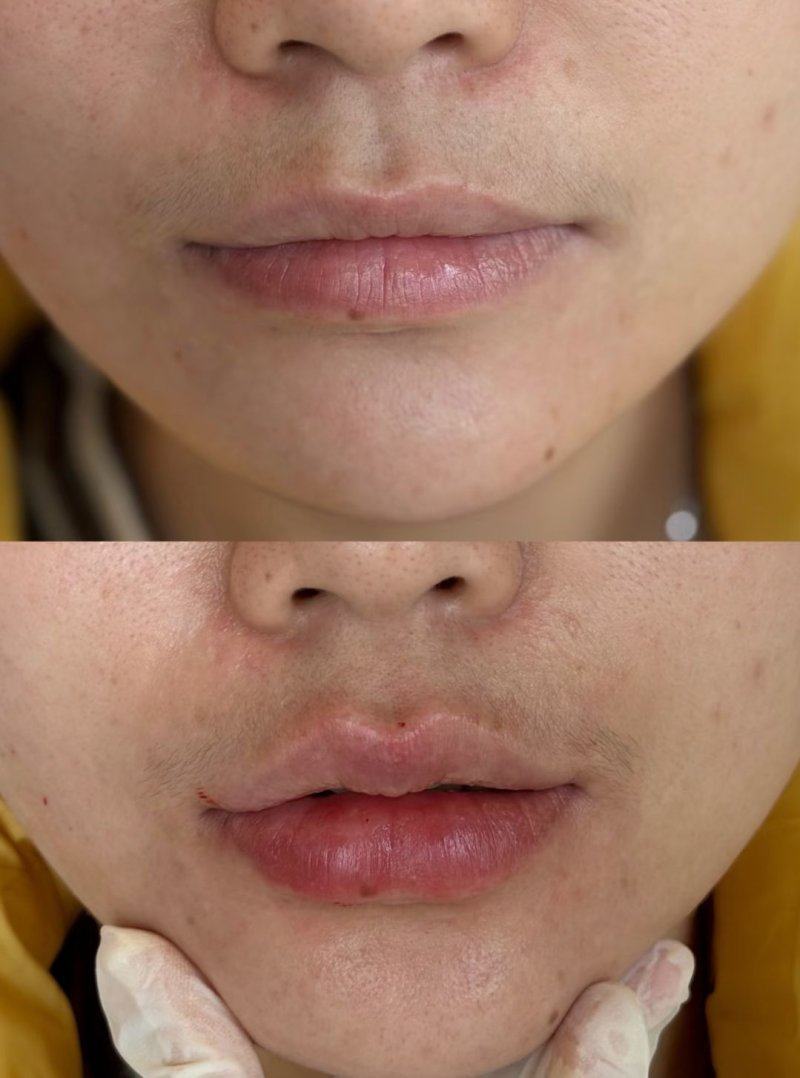 兰州兰熙医疗美容诊所真人口碑评价怎么样？