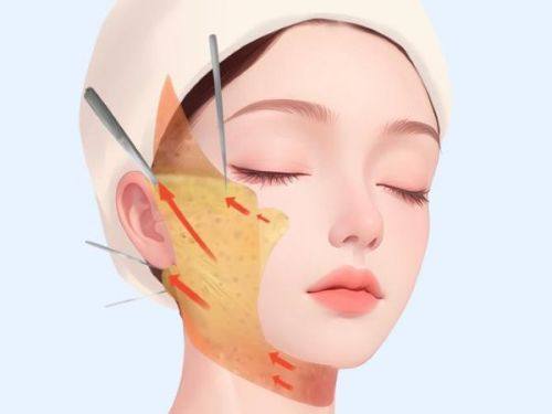 张亚力医生技术优势