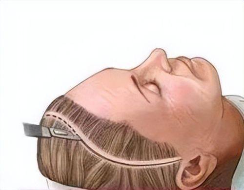 张亚力医生口碑评价及真人实例