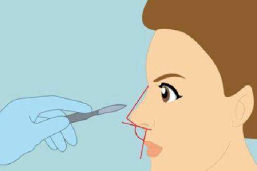 中山熙朵医疗美容门诊部特色项目及技术优势