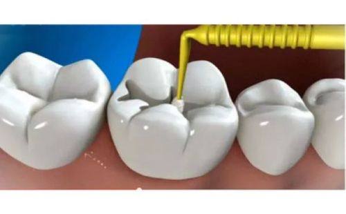 上海山景口腔门诊部收费价格表/收费标准