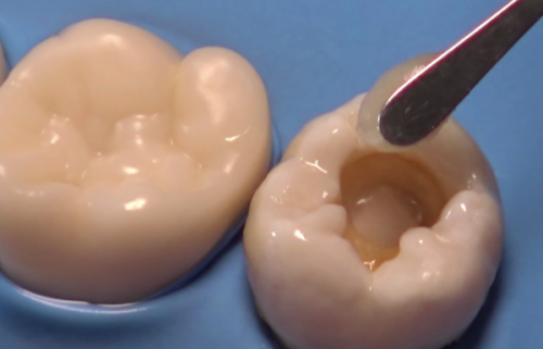 武汉晴川立康口腔（光谷店）收费价格表/收费标准