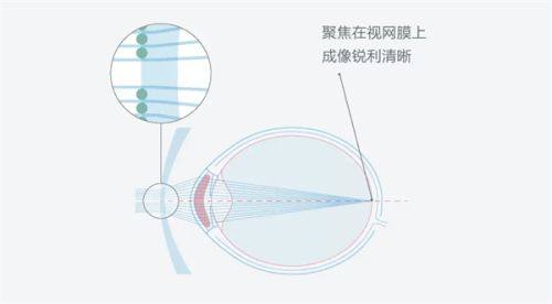 广州康晶眼科整形门诊部地址电话营业时间
