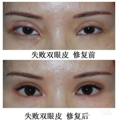 石家庄市第一人民医院整形美容中 心地址电话营业时间