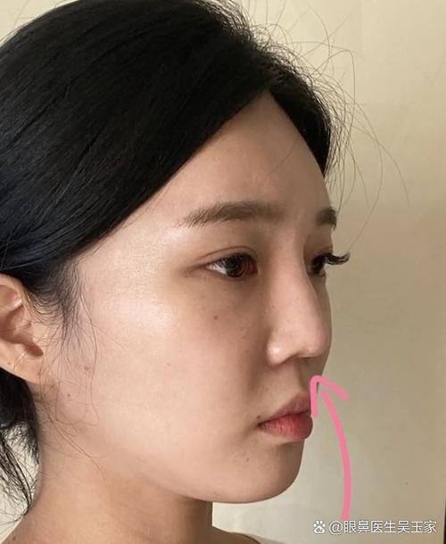 宜昌美岸医疗美容门诊部真人口碑评价怎么样？