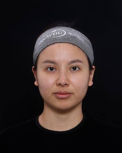 贵州六盘水华美整形特色项目及技术优势