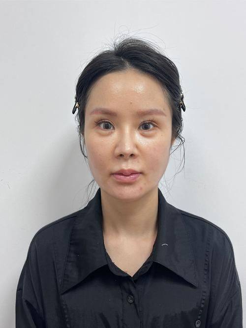 贵州六盘水华美整形真人口碑评价怎么样？