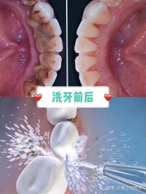 武汉晴川立康口腔（光谷店）真人口碑评价怎么样？