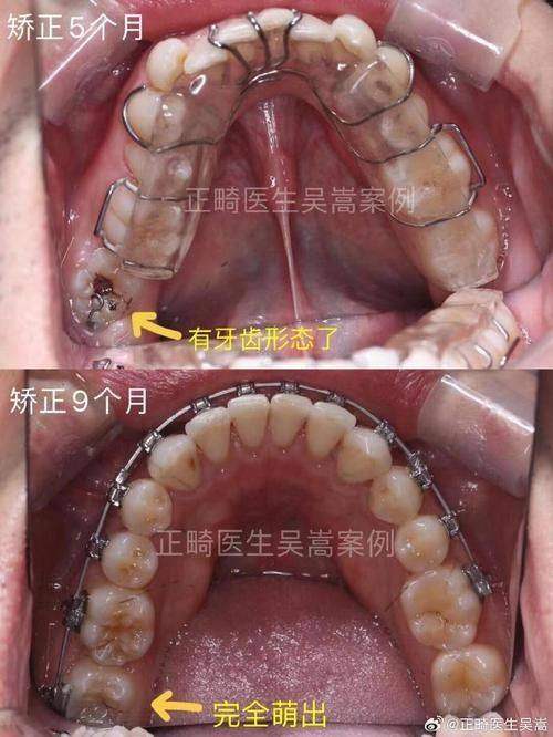 冉超医生口碑评价及真人实例