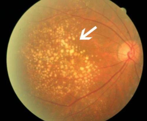 玉林市第二人民医院眼科详细的预约挂号方式及流程