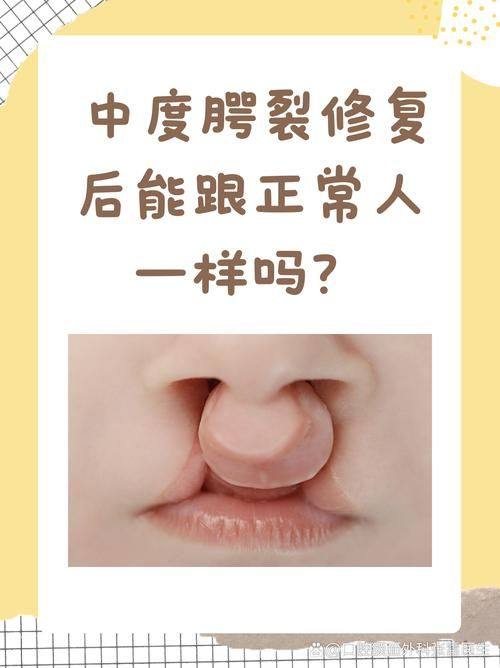 石家庄市第一人民医院整形美容中 心是正规医院吗？