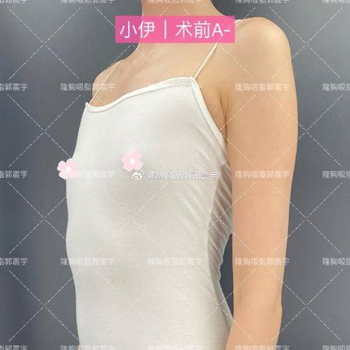 宜昌美岸医疗美容门诊部是正规医院吗？