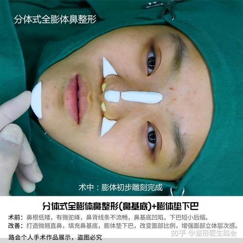 贵州六盘水华美整形收费价格表/收费标准