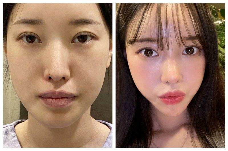 张亚力医生预约挂号