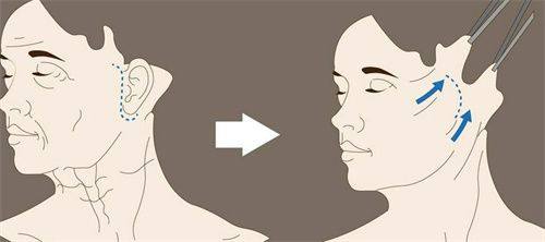 赵文博医生价格表