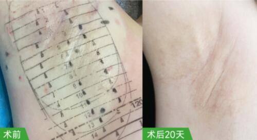 赵文博医生技术优势