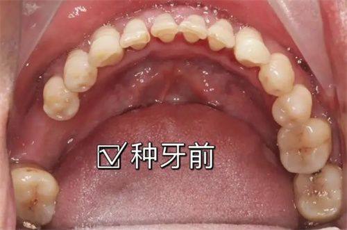 荆门大众楚星万昌口腔门诊地址电话营业时间