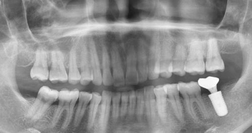 荆门大众楚星万昌口腔门诊真人口碑评价怎么样?