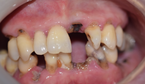 荆门大众楚星万昌口腔门诊详细的预约挂号方式及流程