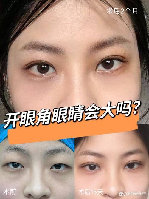 覃寿安医生口碑评价及真人实例