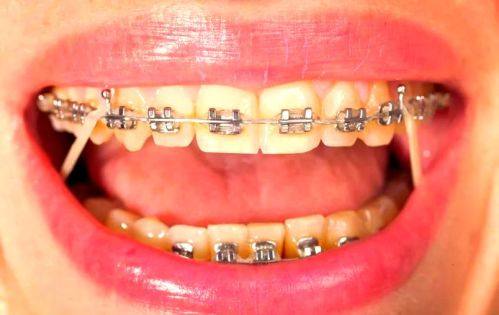 欧忠辉医生技术优势