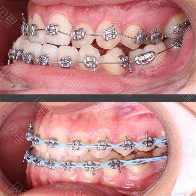 王傲杰医生坐诊医院