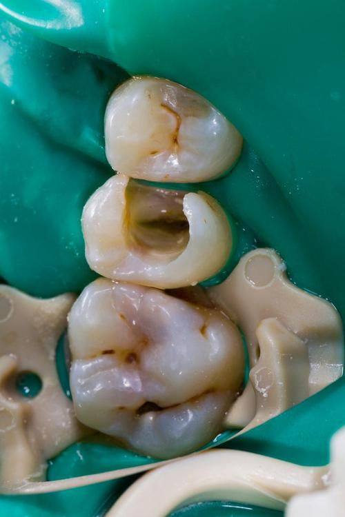 深圳杜正强口腔地址电话营业时间