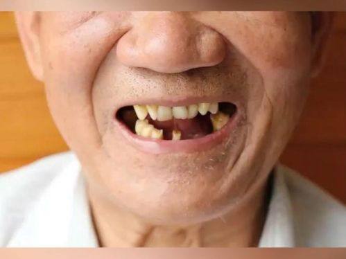 山东泰安肥城张扬口腔是正规医院吗?