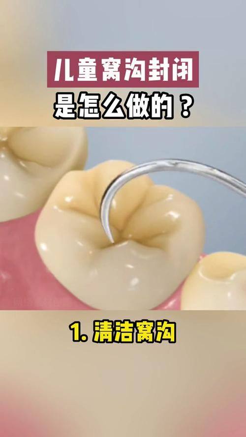 深圳杜正强口腔详细的预约挂号方式及流程