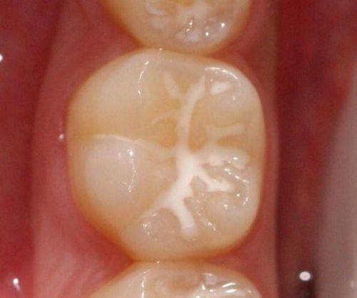 荆门大众楚星万昌口腔门诊收费价格表/收费标准