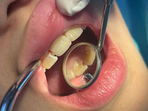 王傲杰医生口碑评价及真人实例