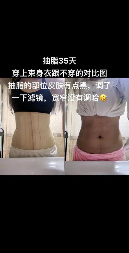 梧州市红十字会医院烧伤整形外科是正规医院吗?